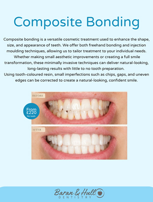 Composite Bonding