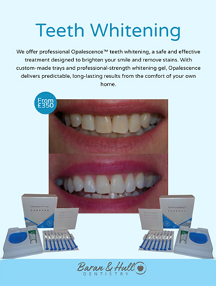 Teeth Whitening