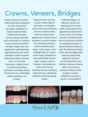 Crowns, Veneers, Bridges