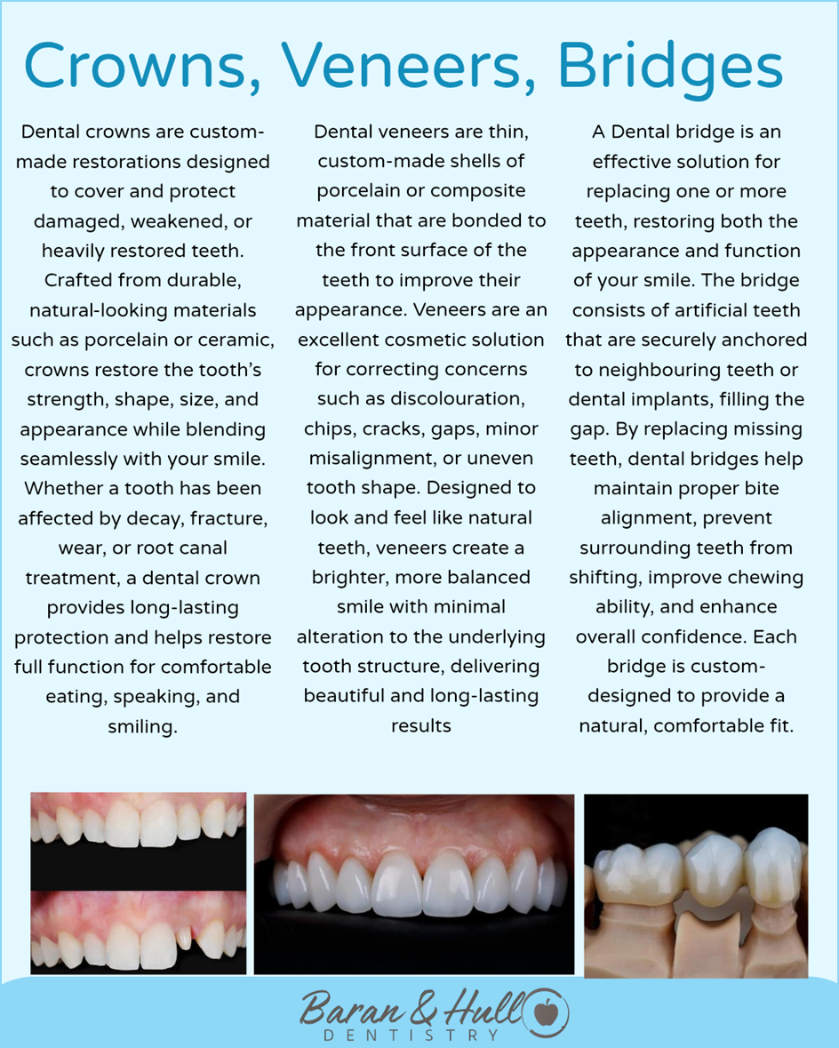 Crowns, Bridges and Veneers
