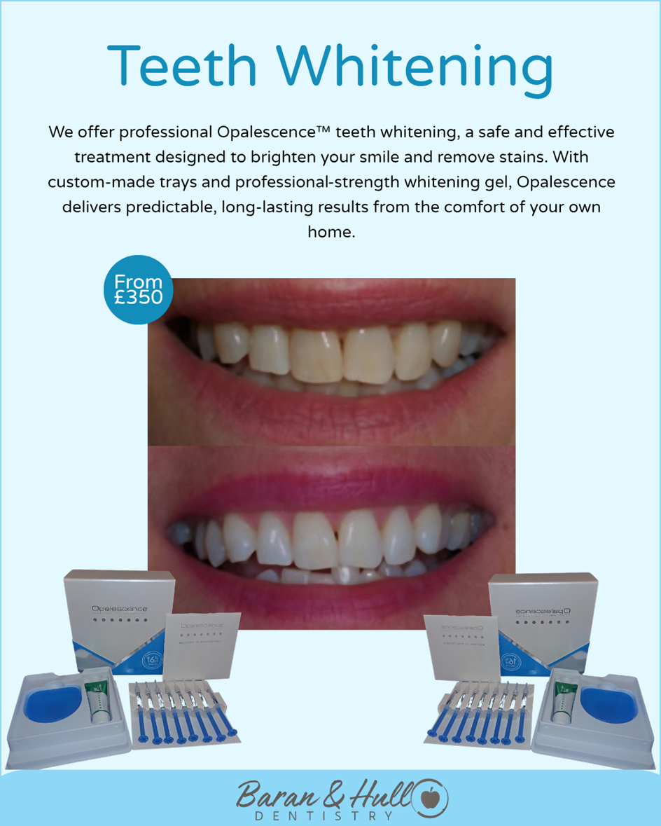 Teeth Whitening